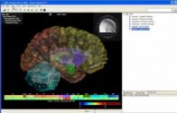 Tutorial: Brain Explorer® 3-D Viewer for the Allen Human Brain Atlas