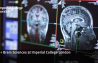 Brain Sciences research at Imperial College London