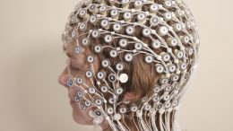EEG-brain-tests-help-patients-overcome-depression