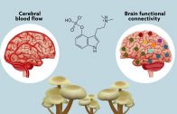 Psilocybin may ‘reset’ the brain to help manage treatment-resistant depression